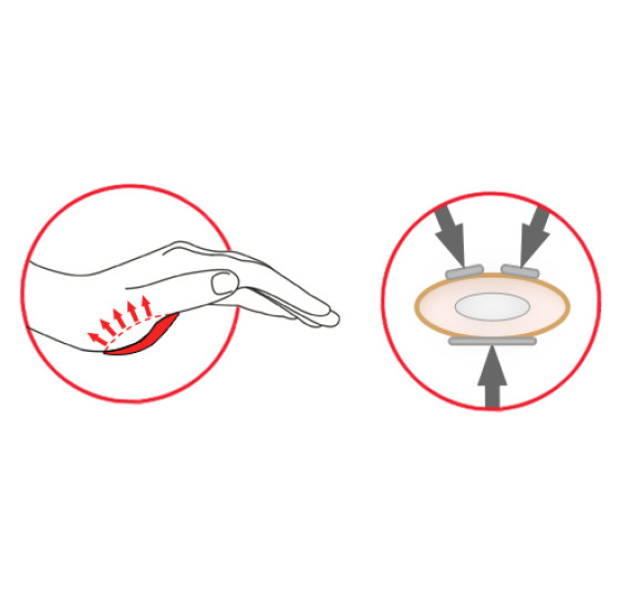 3-точечная фиксация L3P 