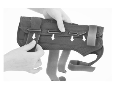 1) Вытяните ремни из пряжек и разверните ортез.