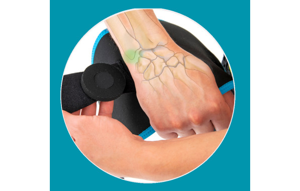 Стабилизация дистального лучелоктевого сустава 