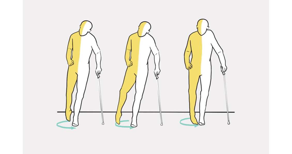 Свисающая стопа