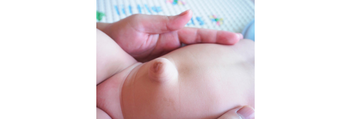 Пупочная грыжа у детей