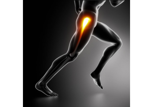 Спортивные травмы тазобедренного сустава