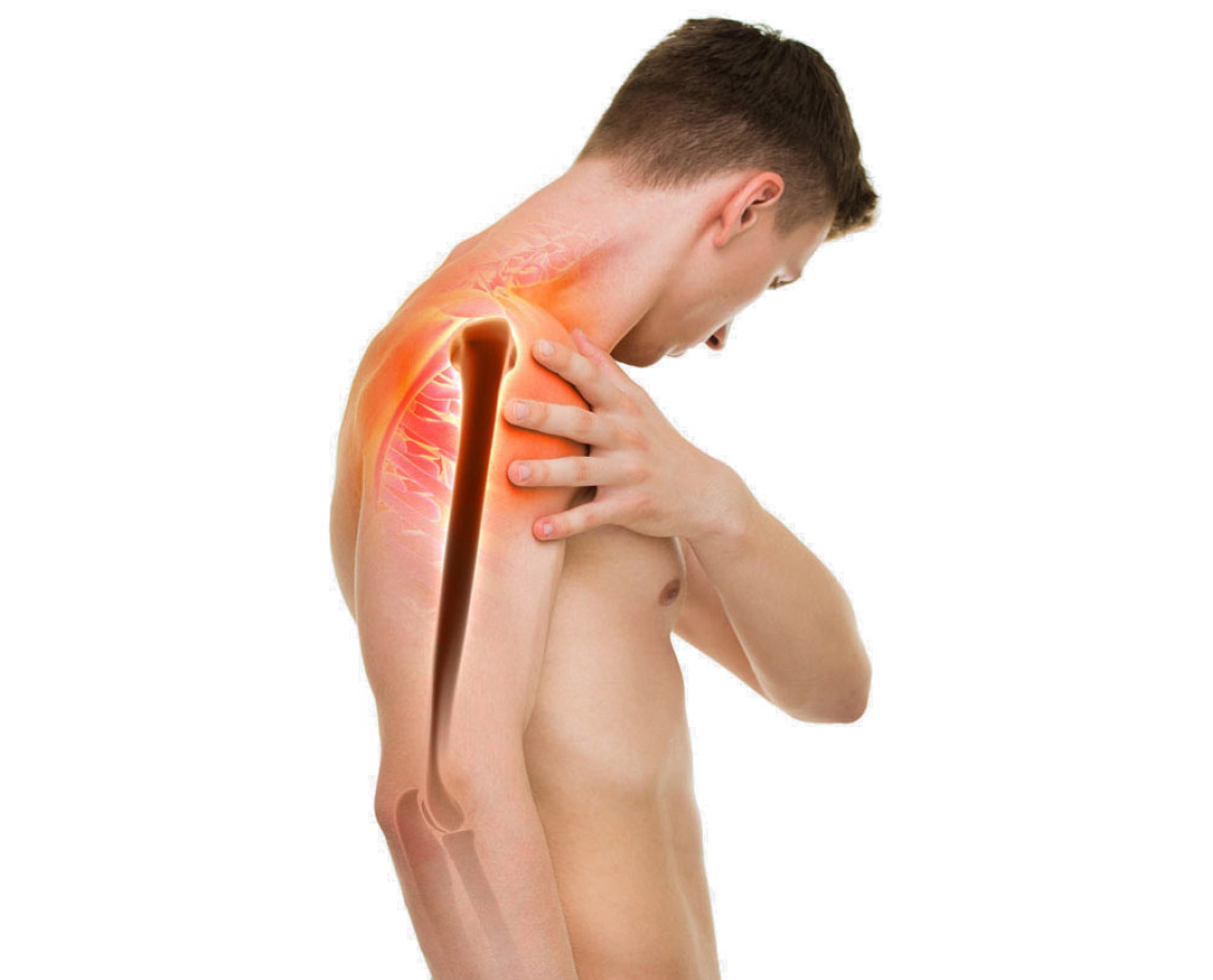 Нестабильность плечевого сустава