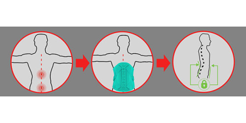 Стабилизация грудо-поясничного отдела