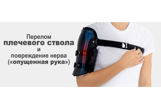 Иммобилизация кости сломанной без смещения