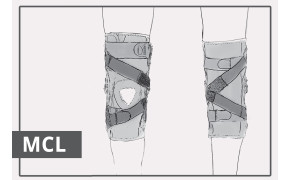 MCL