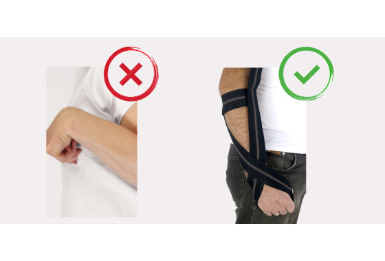 Ортез  предотвращает постисультную спастичность 