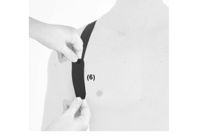 4) Отрегулируйте ремни чтобы уменьшить сублуксацию плеча